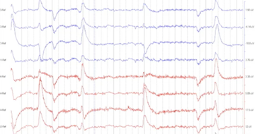 Adverse effects of canine epilepsy